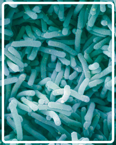 Lactobacillus-casei